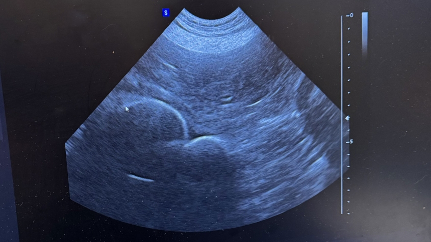Ultrasound of Maisie's stomach, showing the outline of a rubber duck